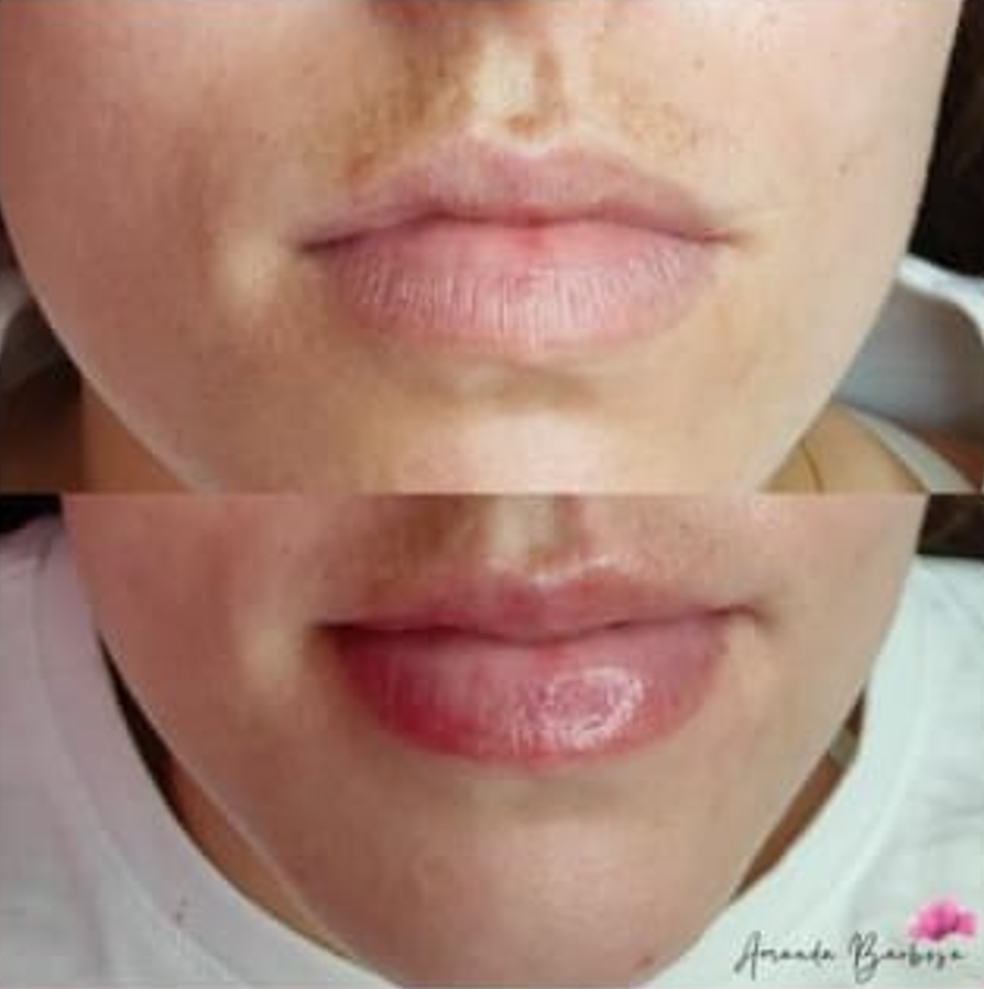 Pump Lips